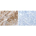 NPY1R Antibody from Signalway Antibody (31282) - Antibodies.com