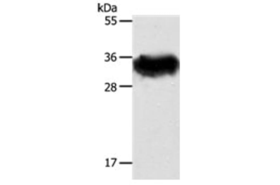 STX1A Antibody from Signalway Antibody (31295) - Antibodies.com