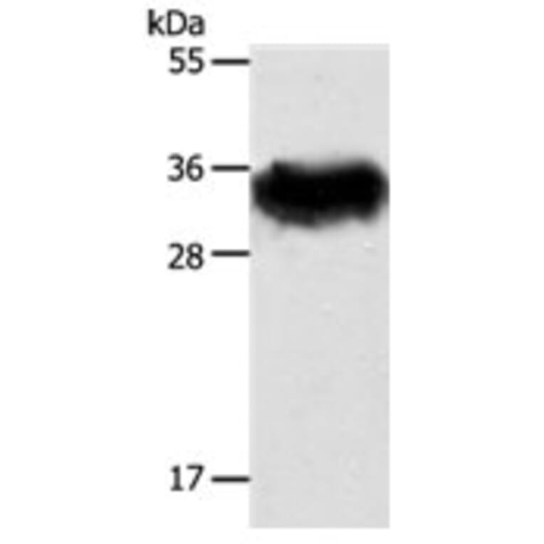 STX1A Antibody from Signalway Antibody (31295) - Antibodies.com
