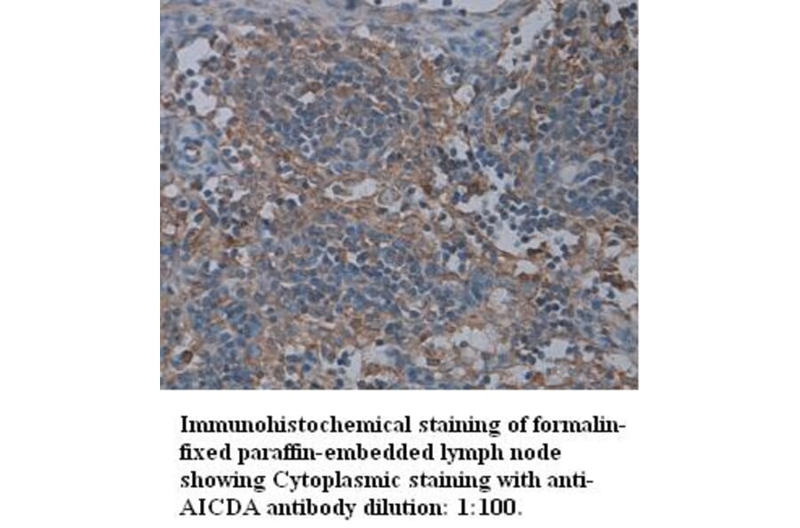 AICDA Antibody from Signalway Antibody (39314) - Antibodies.com