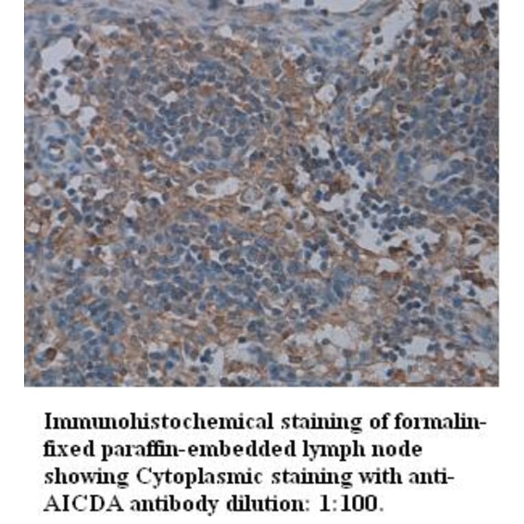 AICDA Antibody from Signalway Antibody (39314) - Antibodies.com