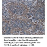 AICDA Antibody from Signalway Antibody (39314) - Antibodies.com