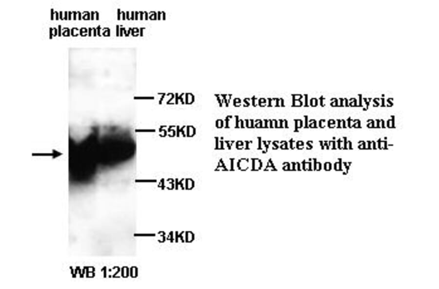 AICDA Antibody from Signalway Antibody (39314) - Antibodies.com