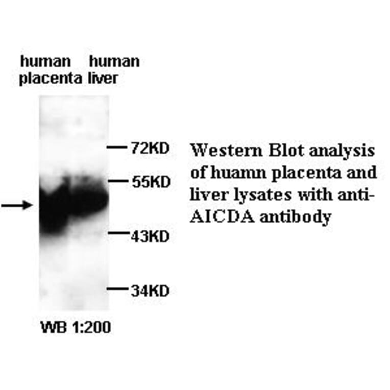 AICDA Antibody from Signalway Antibody (39314) - Antibodies.com