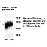 AICDA Antibody from Signalway Antibody (39314) - Antibodies.com