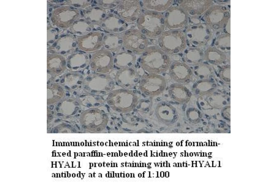 HYAL1 Antibody from Signalway Antibody (39321) - Antibodies.com