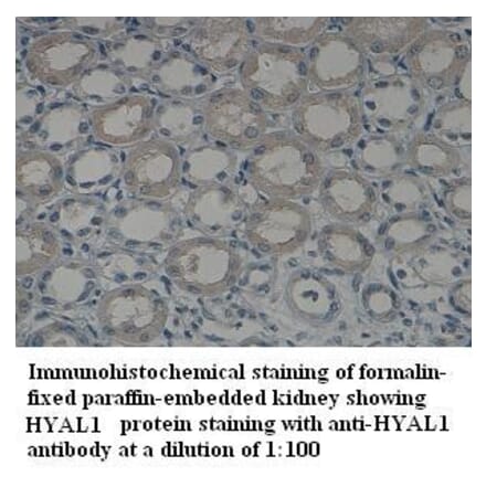 HYAL1 Antibody from Signalway Antibody (39321) - Antibodies.com
