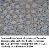 HYAL1 Antibody from Signalway Antibody (39321) - Antibodies.com