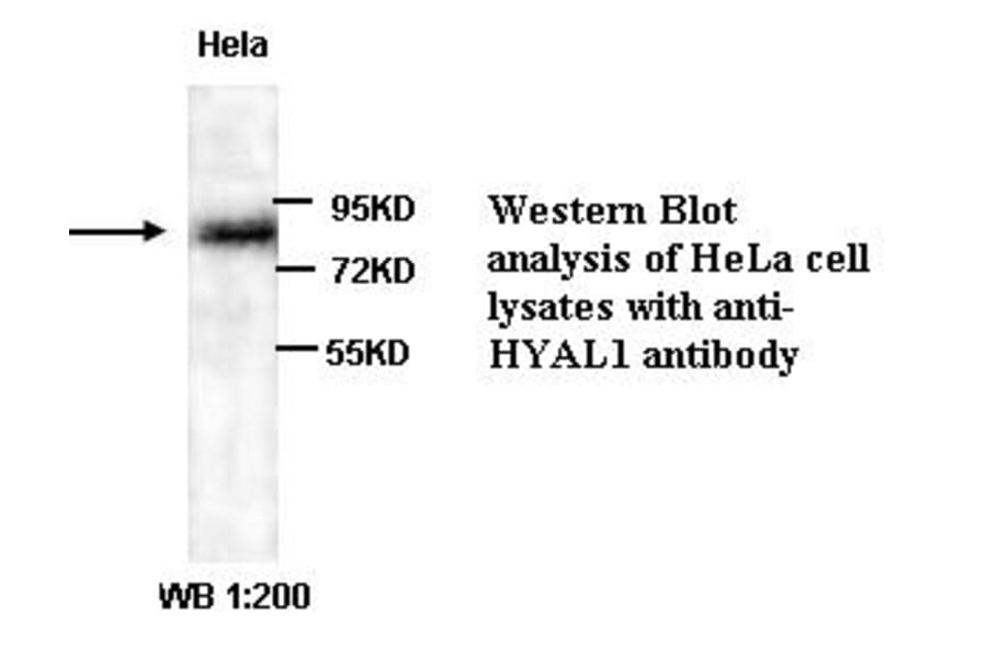 HYAL1 Antibody from Signalway Antibody (39321) - Antibodies.com