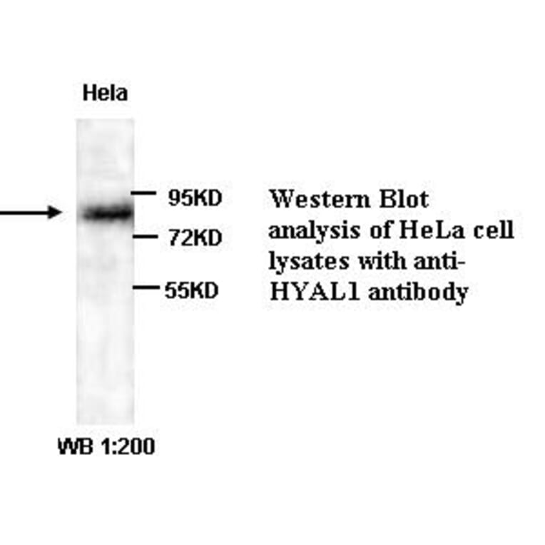 HYAL1 Antibody from Signalway Antibody (39321) - Antibodies.com