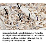 CA IX Antibody from Signalway Antibody (39324) - Antibodies.com