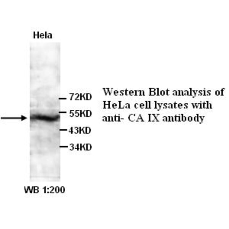 CA IX Antibody from Signalway Antibody (39324) - Antibodies.com