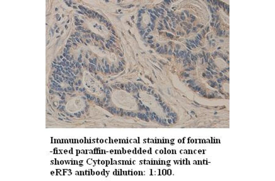 GSPT1 Antibody from Signalway Antibody (39327) - Antibodies.com