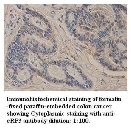 GSPT1 Antibody from Signalway Antibody (39327) - Antibodies.com