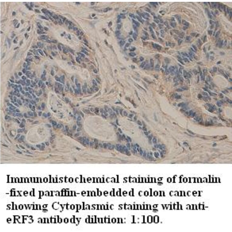 GSPT1 Antibody from Signalway Antibody (39327) - Antibodies.com