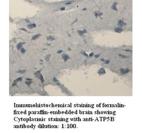 ATP6B Antibody from Signalway Antibody (39334) - Antibodies.com