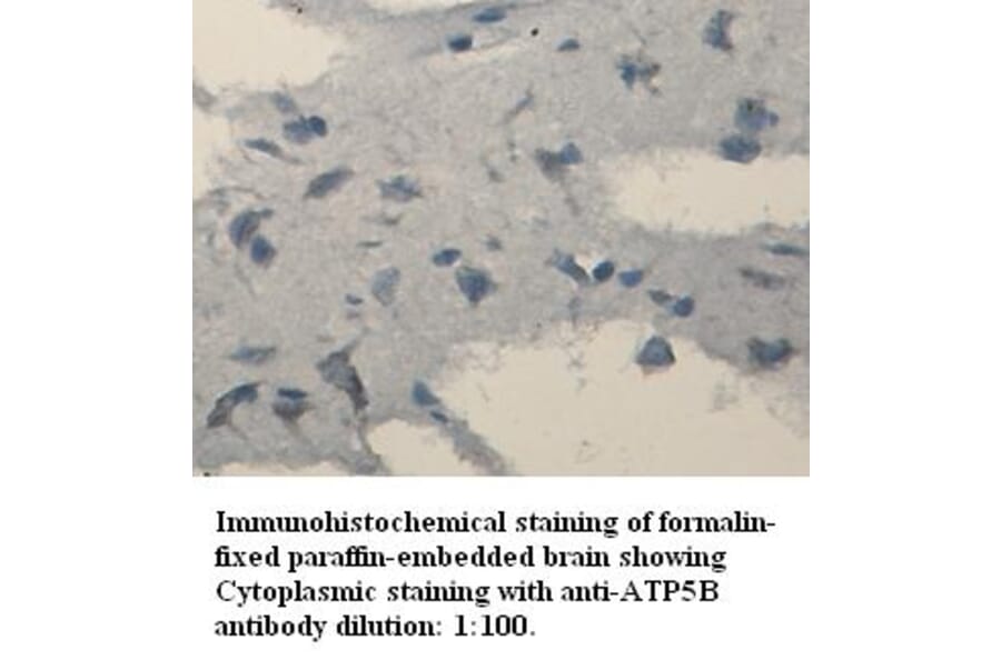 ATP6B Antibody from Signalway Antibody (39334) - Antibodies.com