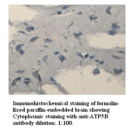 ATP6B Antibody from Signalway Antibody (39334) - Antibodies.com