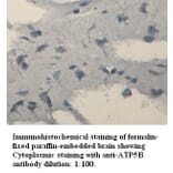 ATP6B Antibody from Signalway Antibody (39334) - Antibodies.com