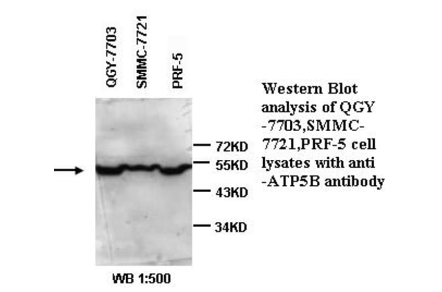 ATP6B Antibody from Signalway Antibody (39334) - Antibodies.com