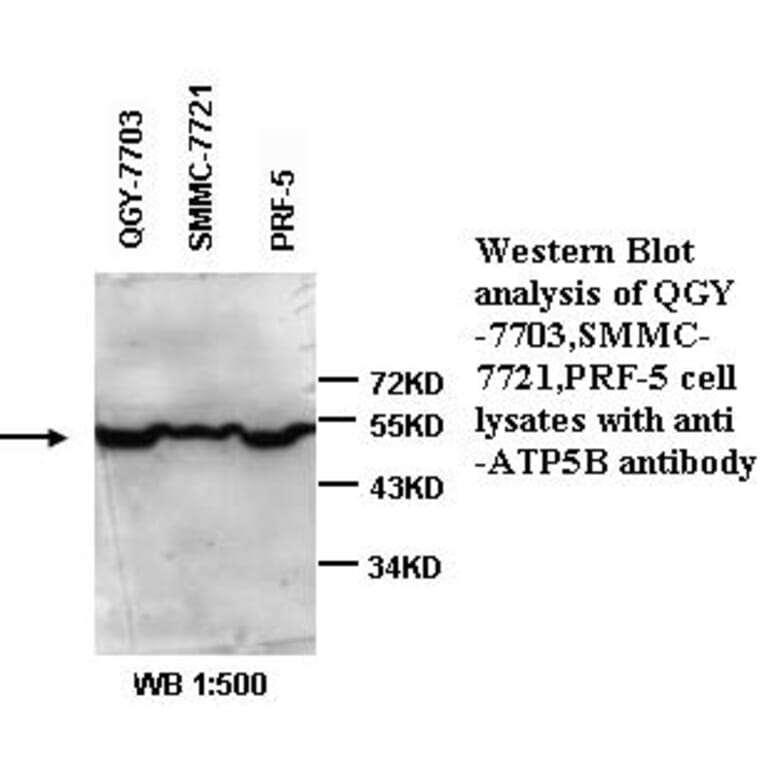 ATP6B Antibody from Signalway Antibody (39334) - Antibodies.com