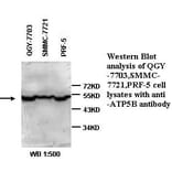 ATP6B Antibody from Signalway Antibody (39334) - Antibodies.com