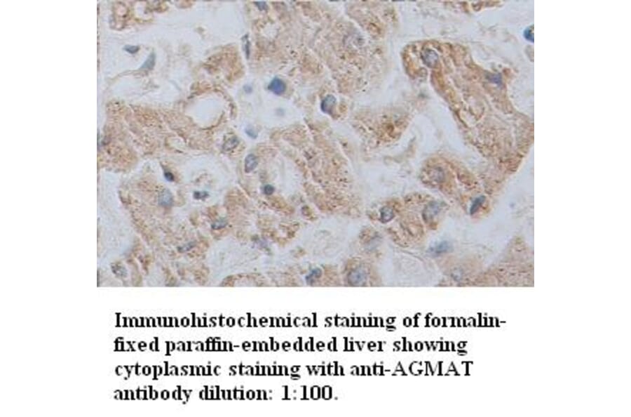 AGMAT Antibody from Signalway Antibody (39347) - Antibodies.com