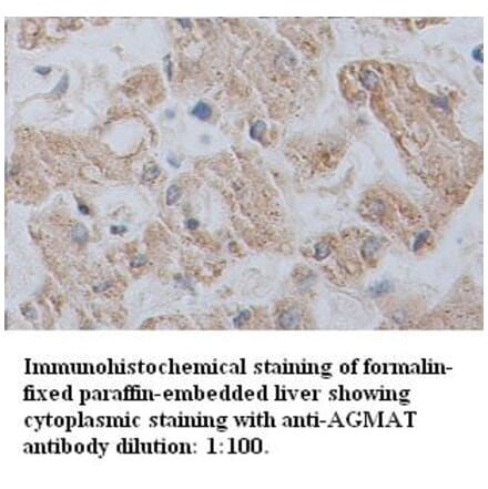 AGMAT Antibody from Signalway Antibody (39347) - Antibodies.com