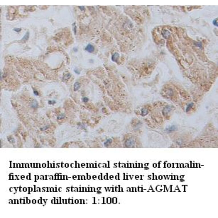 AGMAT Antibody from Signalway Antibody (39347) - Antibodies.com