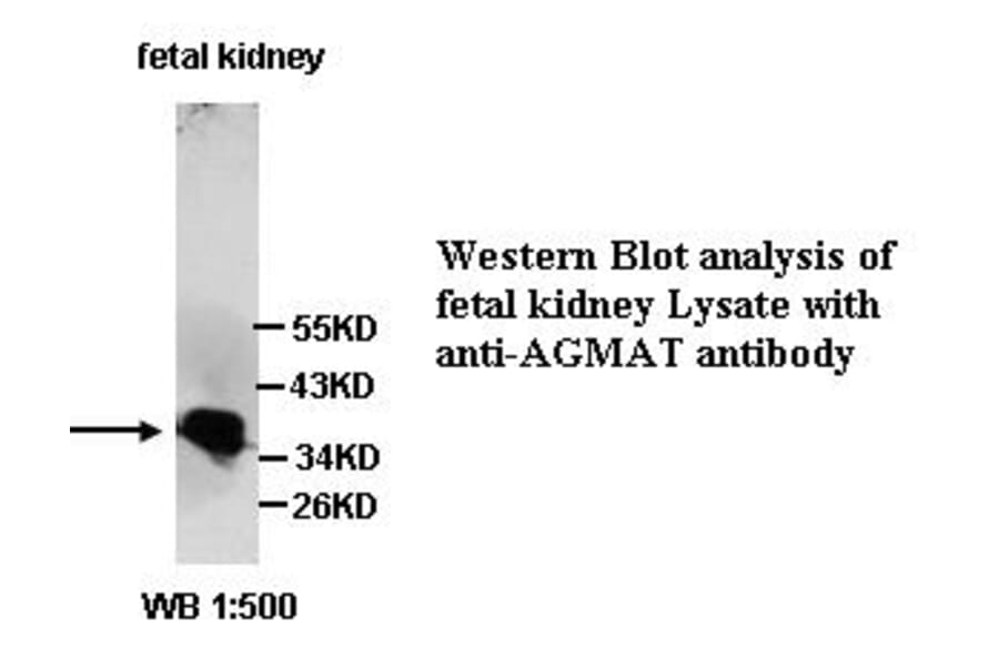 AGMAT Antibody from Signalway Antibody (39347) - Antibodies.com