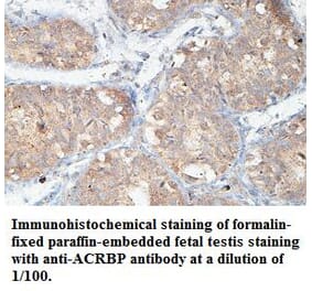 ACRBP Antibody from Signalway Antibody (39438) - Antibodies.com
