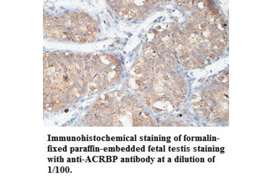 ACRBP Antibody from Signalway Antibody (39438) - Antibodies.com