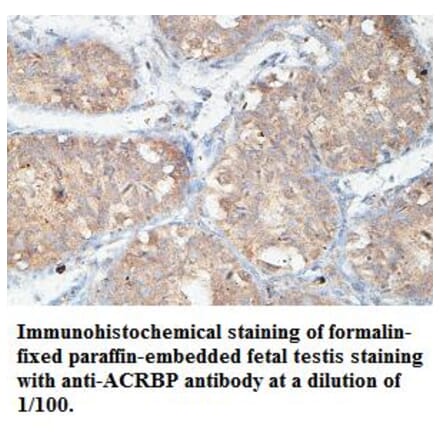 ACRBP Antibody from Signalway Antibody (39438) - Antibodies.com