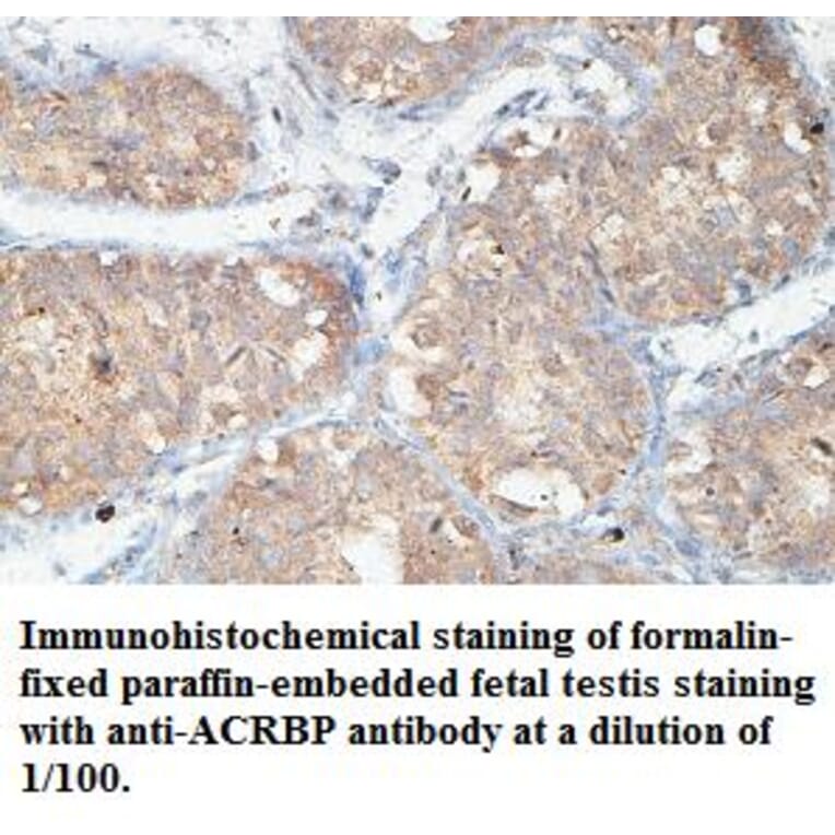 ACRBP Antibody from Signalway Antibody (39438) - Antibodies.com