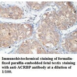 ACRBP Antibody from Signalway Antibody (39438) - Antibodies.com