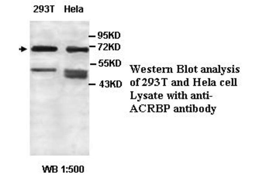 ACRBP Antibody from Signalway Antibody (39438) - Antibodies.com