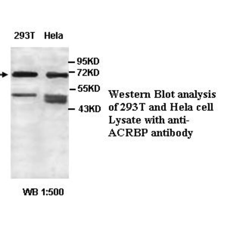 ACRBP Antibody from Signalway Antibody (39438) - Antibodies.com