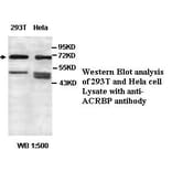 ACRBP Antibody from Signalway Antibody (39438) - Antibodies.com