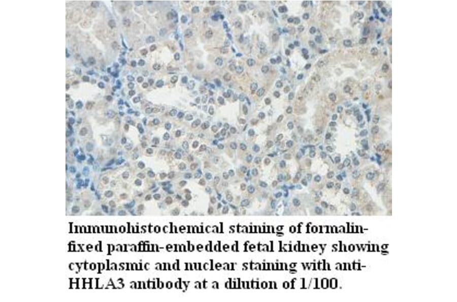 HHLA3 Antibody from Signalway Antibody (39441) - Antibodies.com