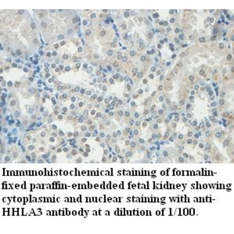 HHLA3 Antibody from Signalway Antibody (39441) - Antibodies.com