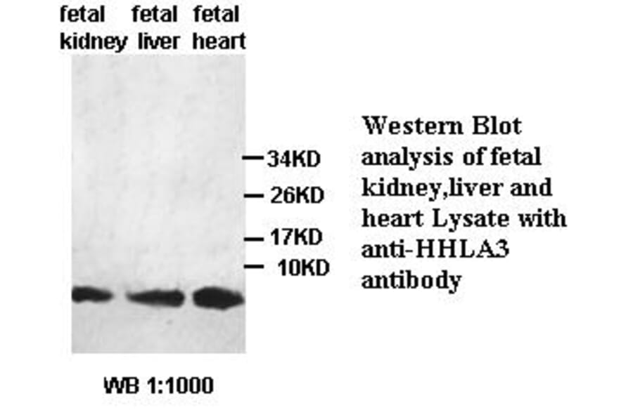 HHLA3 Antibody from Signalway Antibody (39441) - Antibodies.com