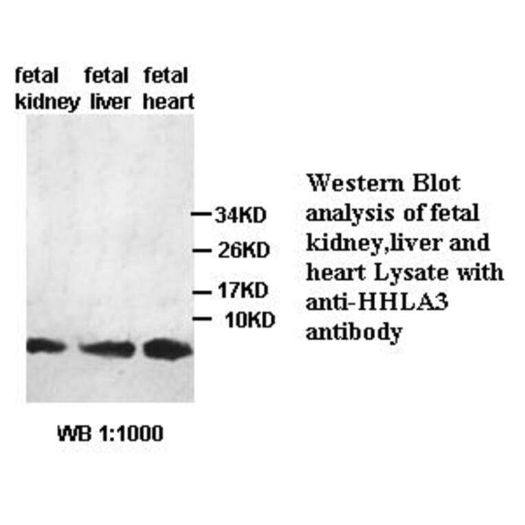 HHLA3 Antibody from Signalway Antibody (39441) - Antibodies.com