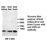 HHLA3 Antibody from Signalway Antibody (39441) - Antibodies.com