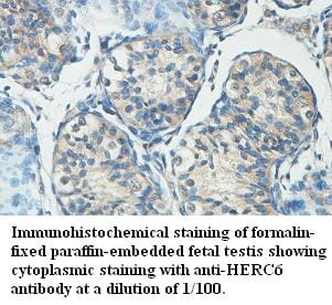 Anti-HERC6 Antibody