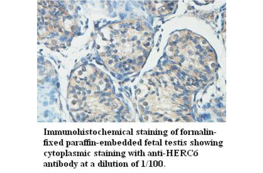 HERC6 Antibody from Signalway Antibody (39442) - Antibodies.com