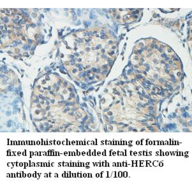 HERC6 Antibody from Signalway Antibody (39442) - Antibodies.com