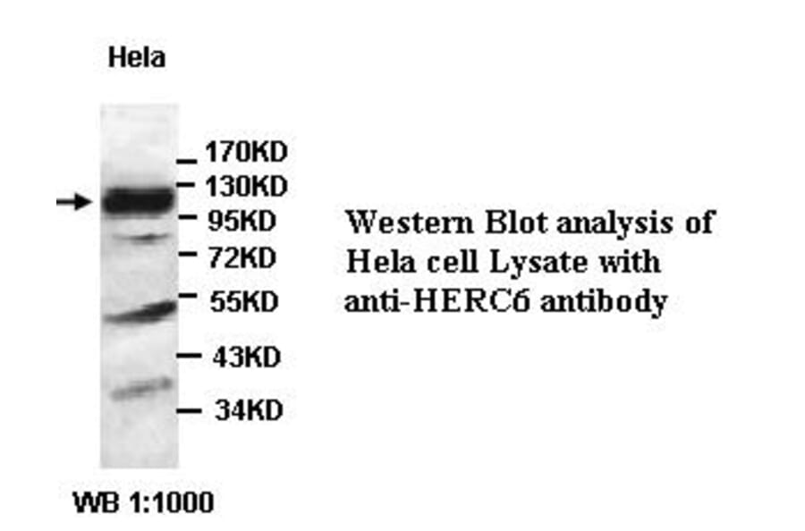 HERC6 Antibody from Signalway Antibody (39442) - Antibodies.com