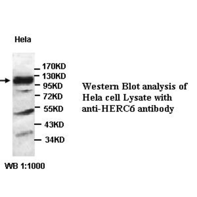 HERC6 Antibody from Signalway Antibody (39442) - Antibodies.com