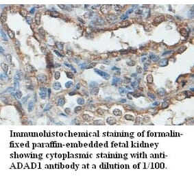 ADAD1 Antibody from Signalway Antibody (39480) - Antibodies.com