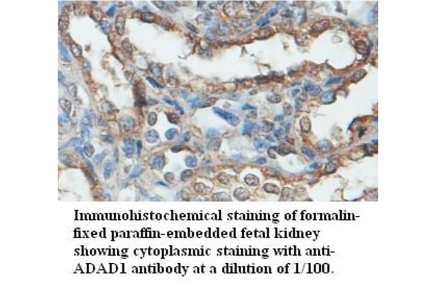 ADAD1 Antibody from Signalway Antibody (39480) - Antibodies.com